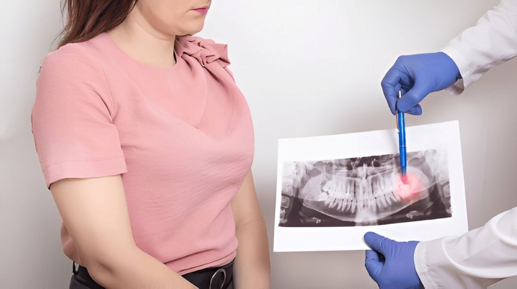 wisdom tooth extraction in langley